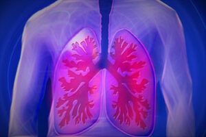 Lee más sobre el artículo Día Mundial de la Enfermedad Pulmonar Obstructiva Crónica